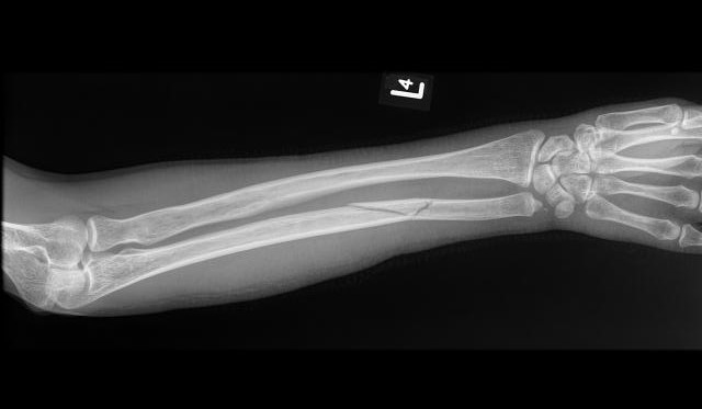 Czarnobyl. Mariupol. Warszawa.